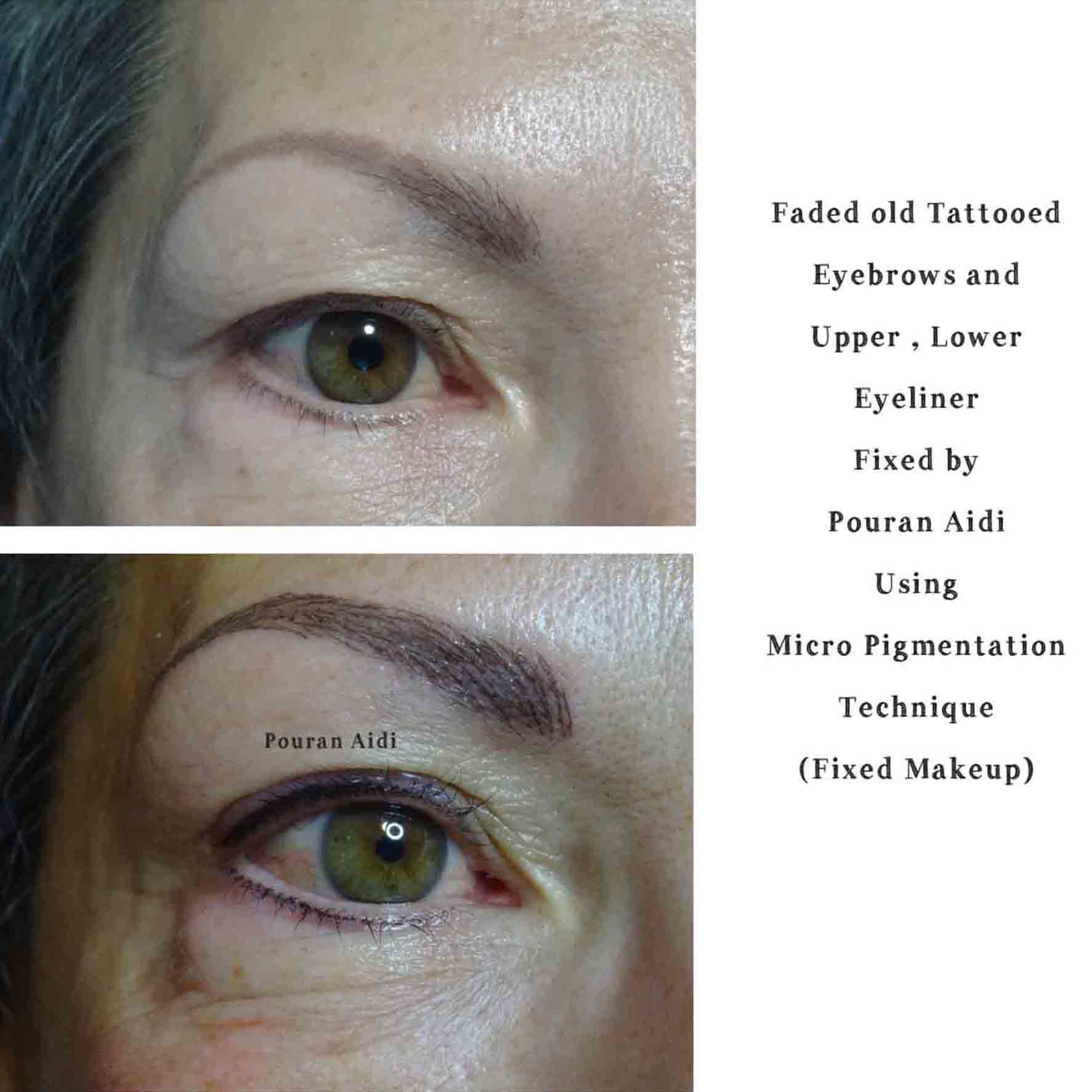 Micro Pigmentation for Eyeliner, Before and After Photo