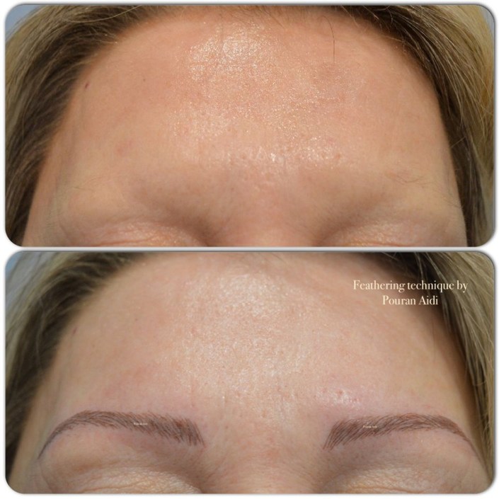 Permanent Eyebrows Before and After